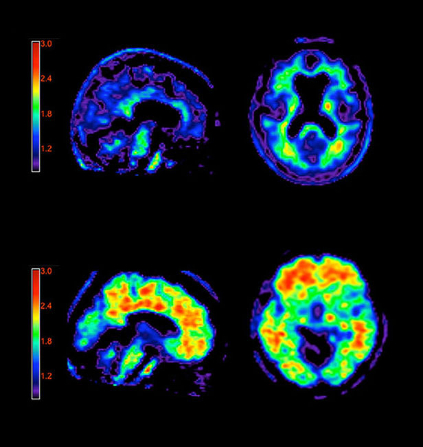 Brain Imaging Tests