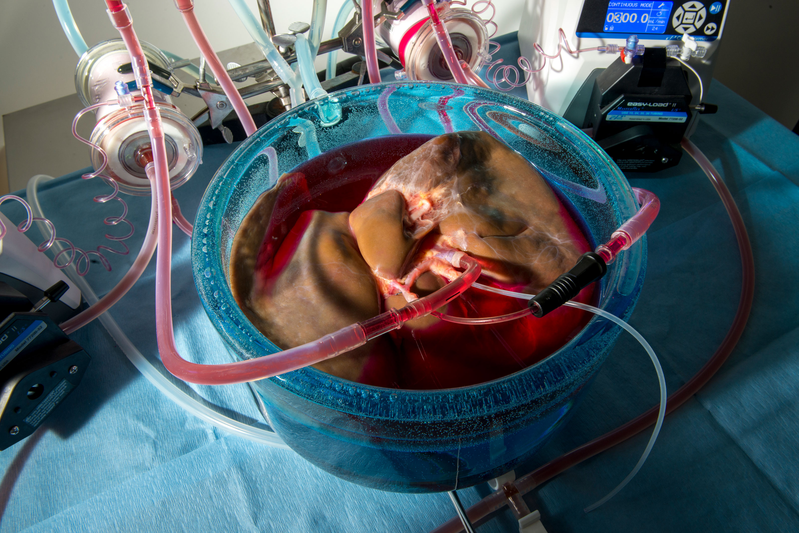 photo of a human liver during machine perfusion while it is being preconditioned with protective agents for supercooled storage