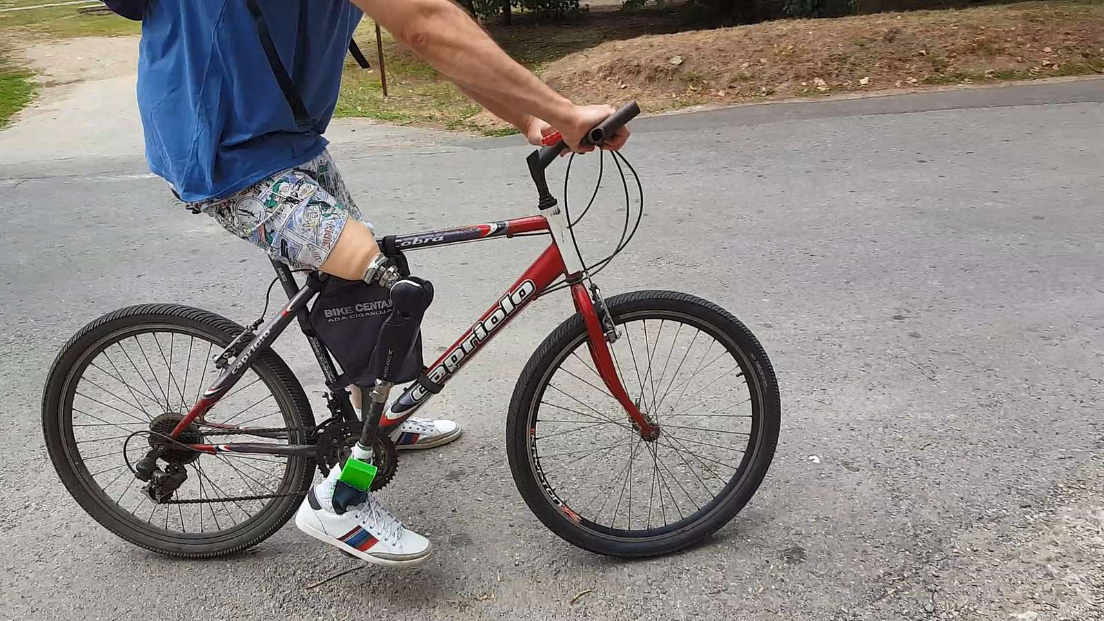 A man with a prosthetic leg riding a bicycle