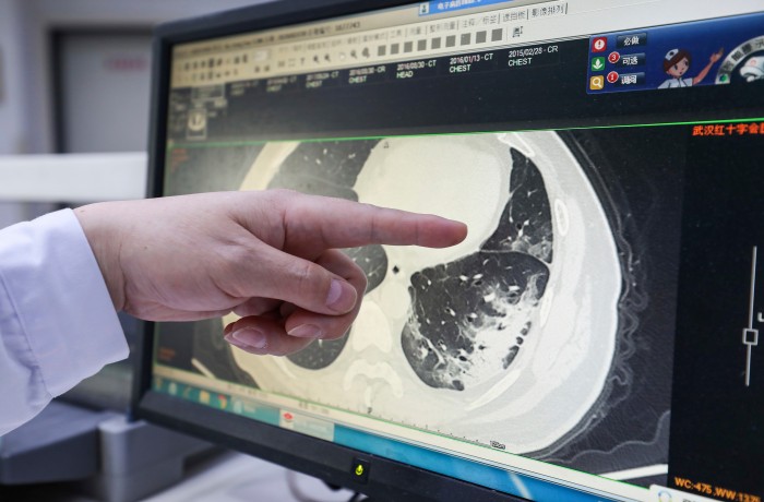 Doctor pointing at a CT scan