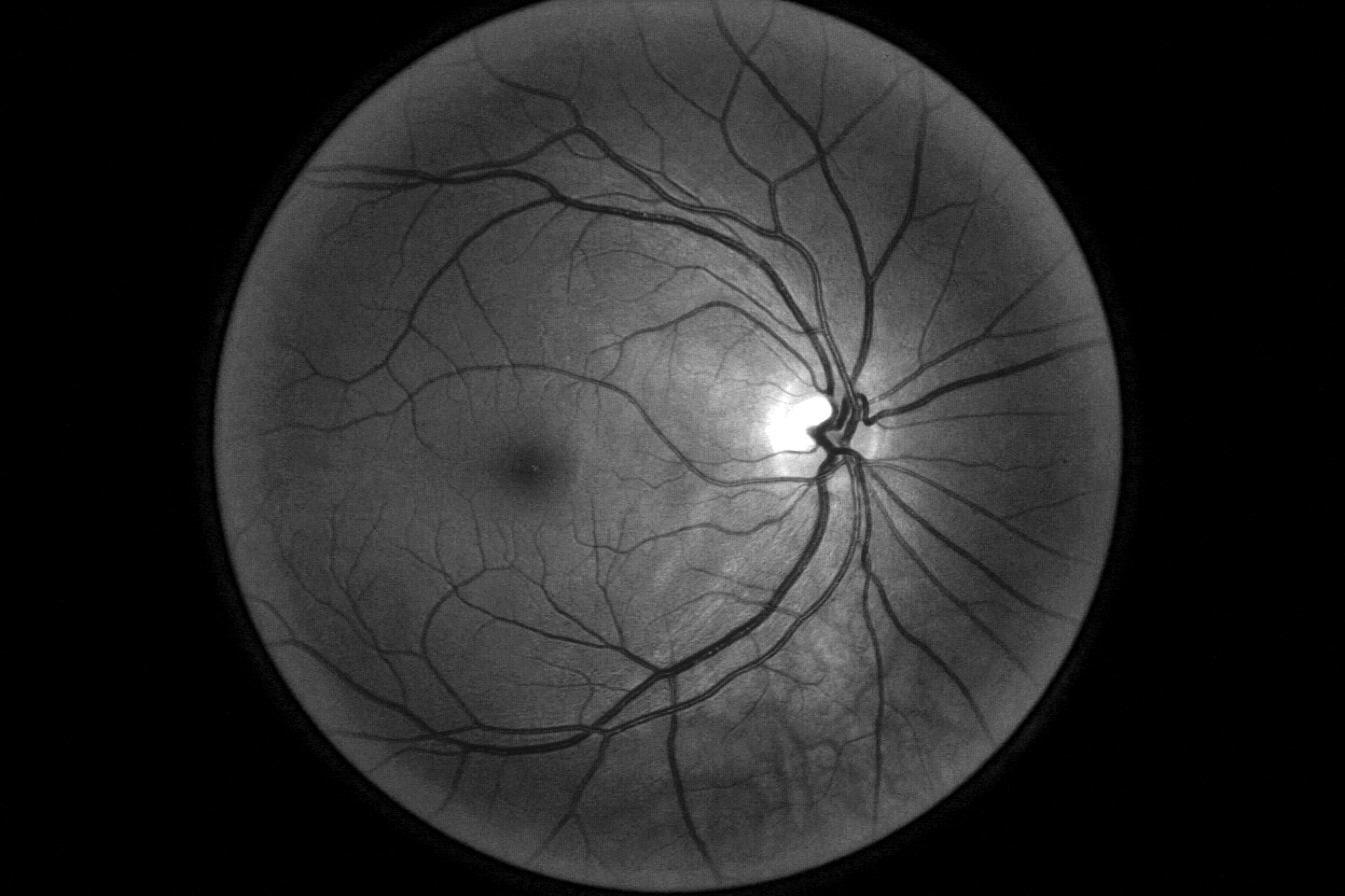fundus camera image of retina