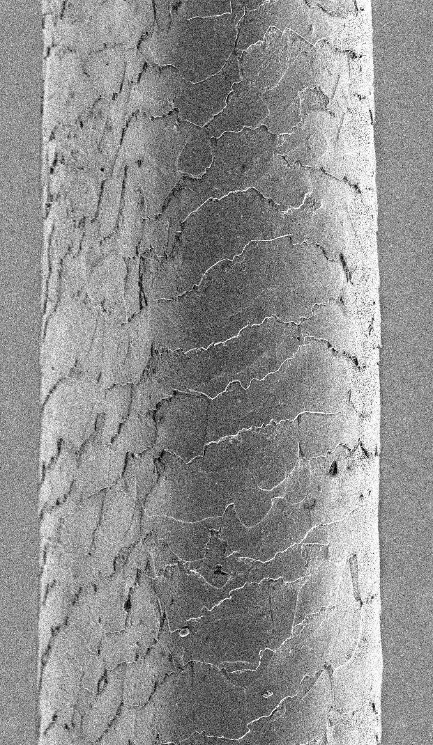 human hair under a microscope