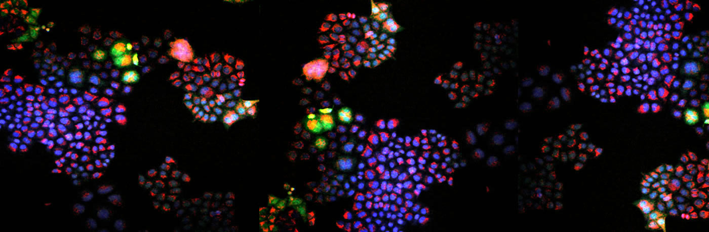 Fluorescence microscopy image of a tumor
