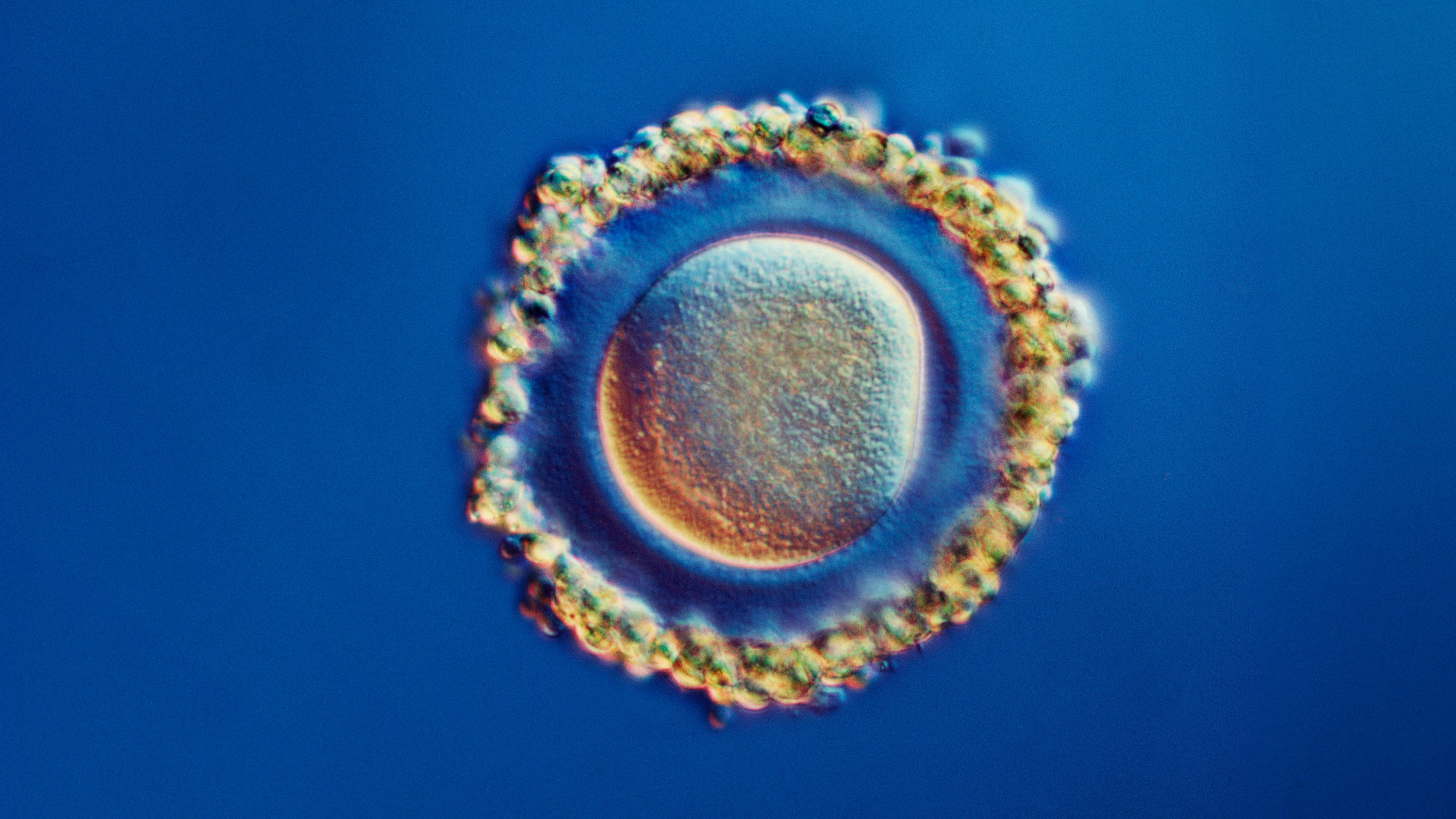 light micrograph of a mature human egg