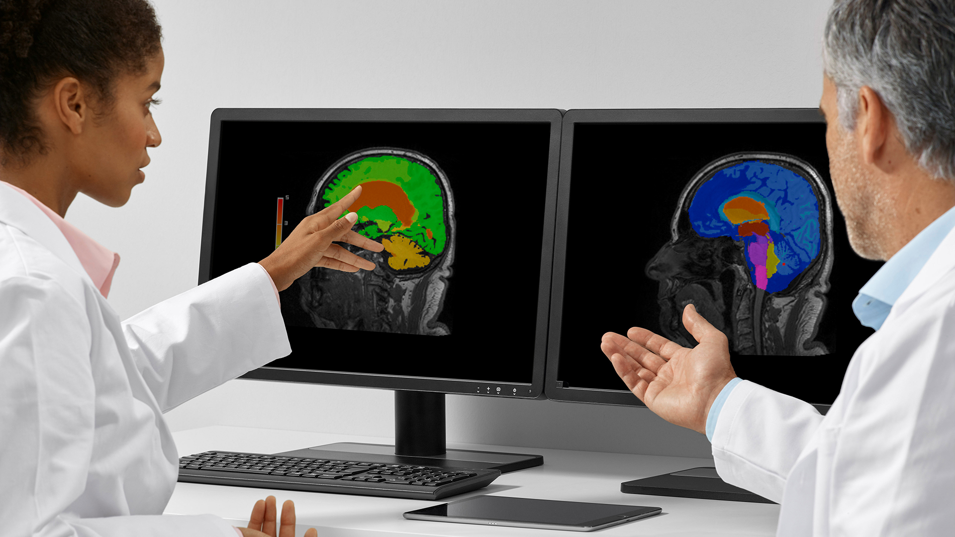 Evaluación de resonancias magnéticas cerebrales con la ayuda de inteligencia artificial