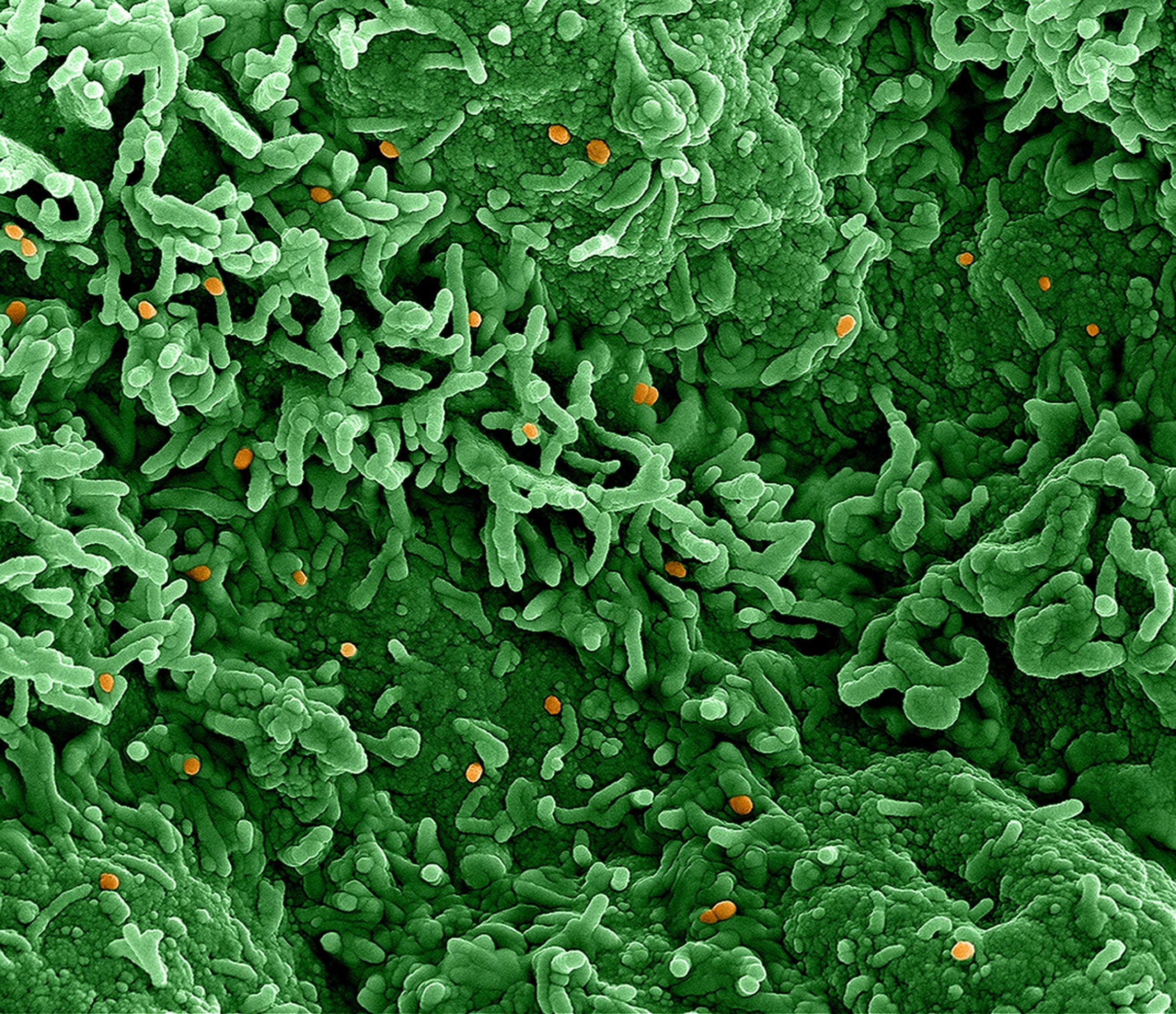 Orange dots appear scattered in a series of green protrusions and tubes.