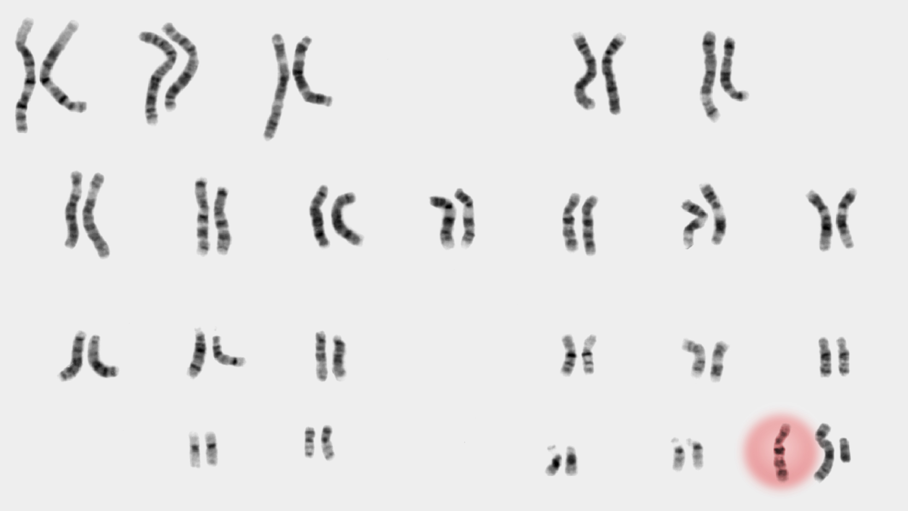 chromosome pairs with an additional chromosome highlighted