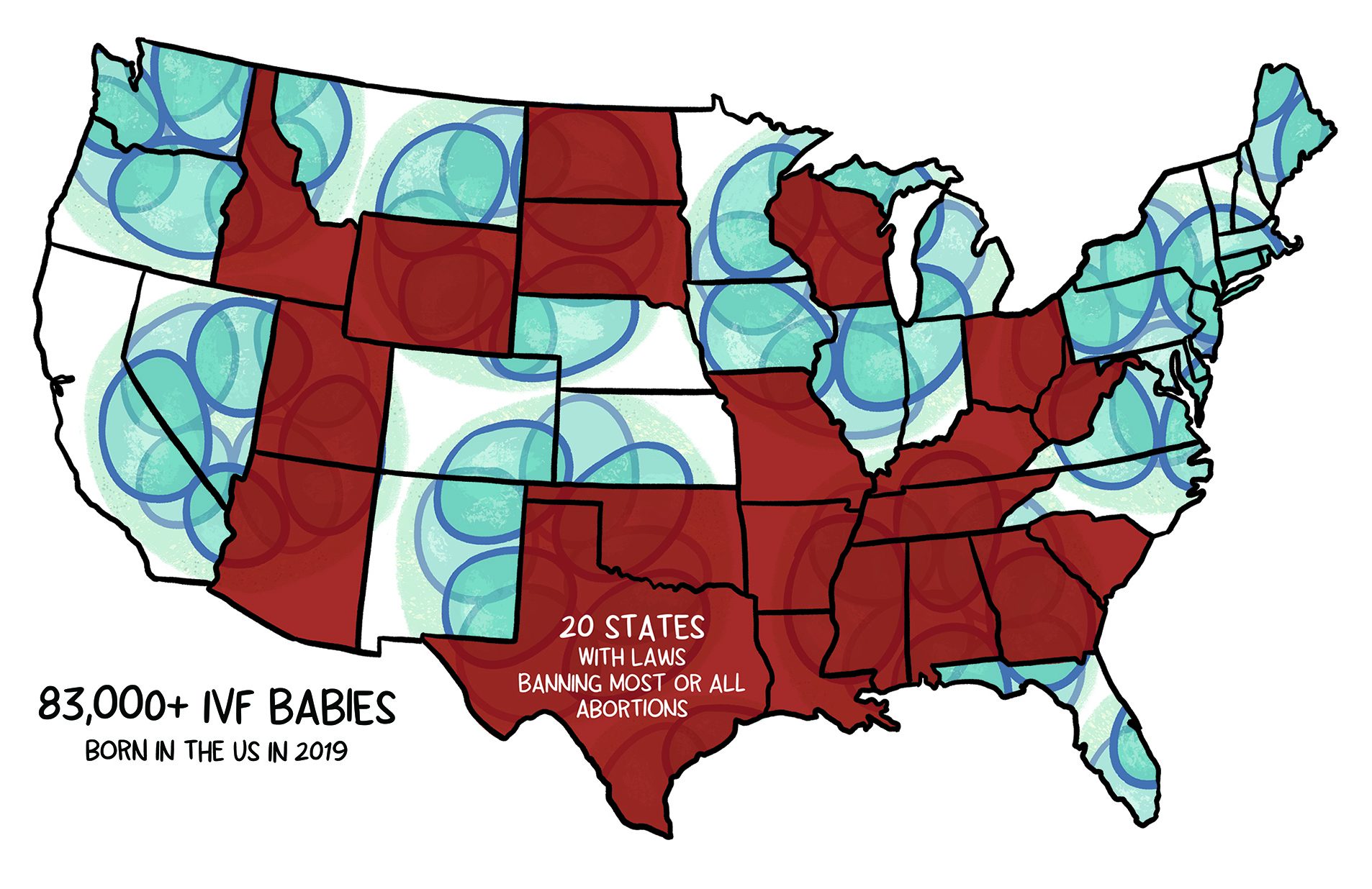 stylized map of the United States with caption, 83,000+ IVF babies born in the U-S in 2019.  On the state of Texas it reads: 20 states with laws banning most or all abortions. 