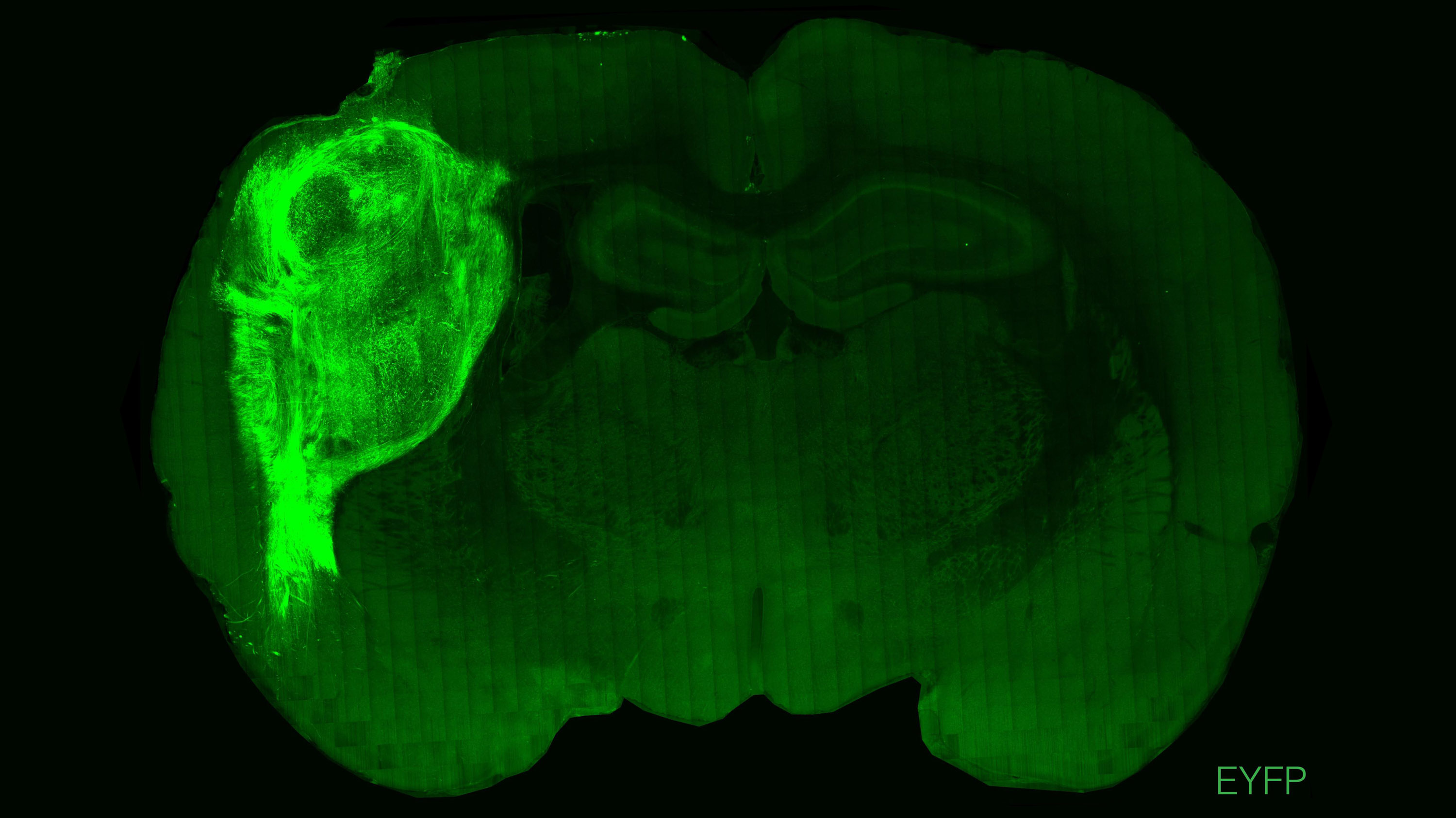 Organoide humano trasplantado marcado con proteína fluorescente en el cerebro de una rata