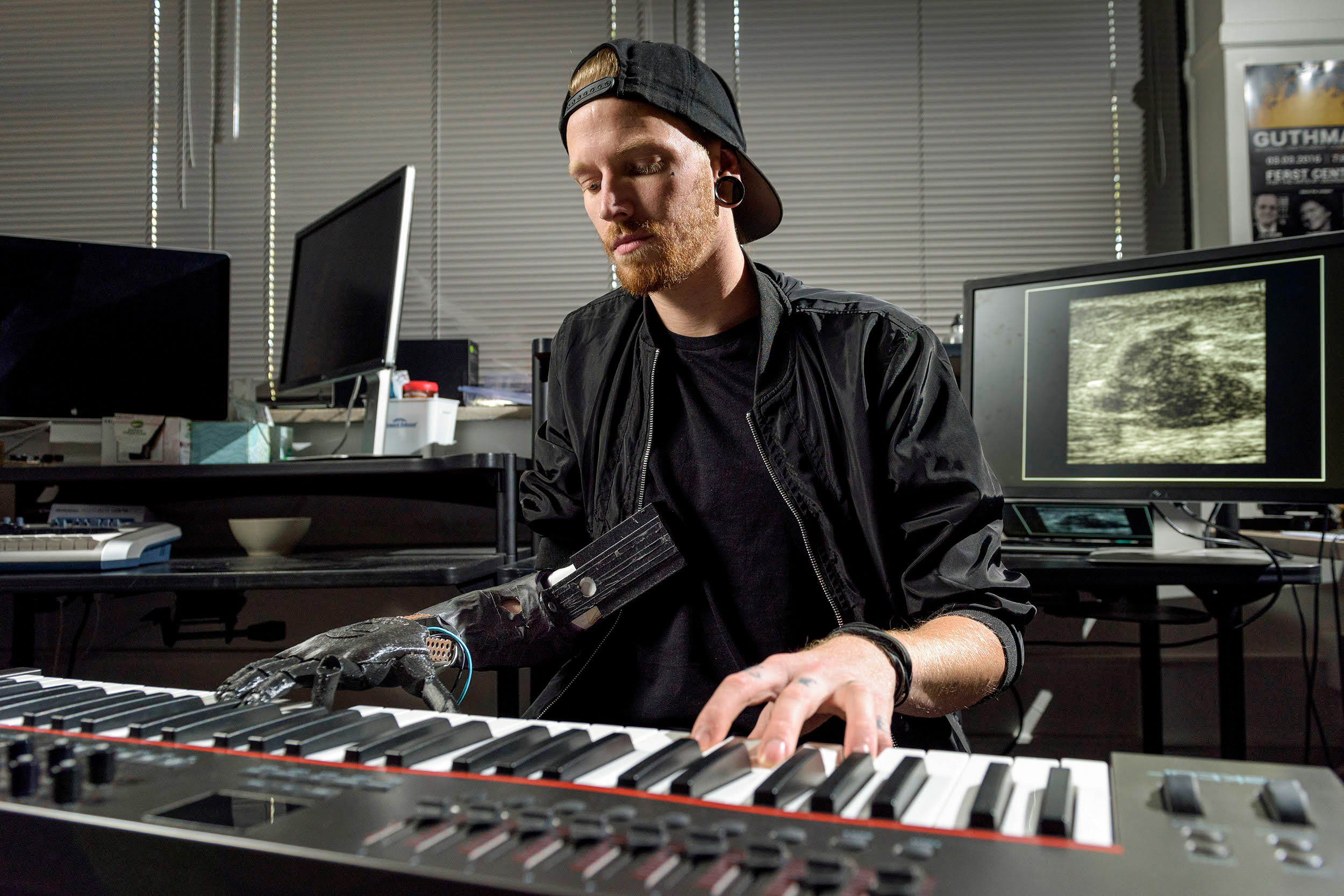 Barnes toca teclado con prótesis de mano
