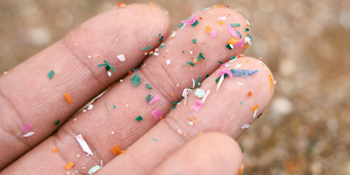 Microplastics are in every single place. What does that imply for our immune programs?