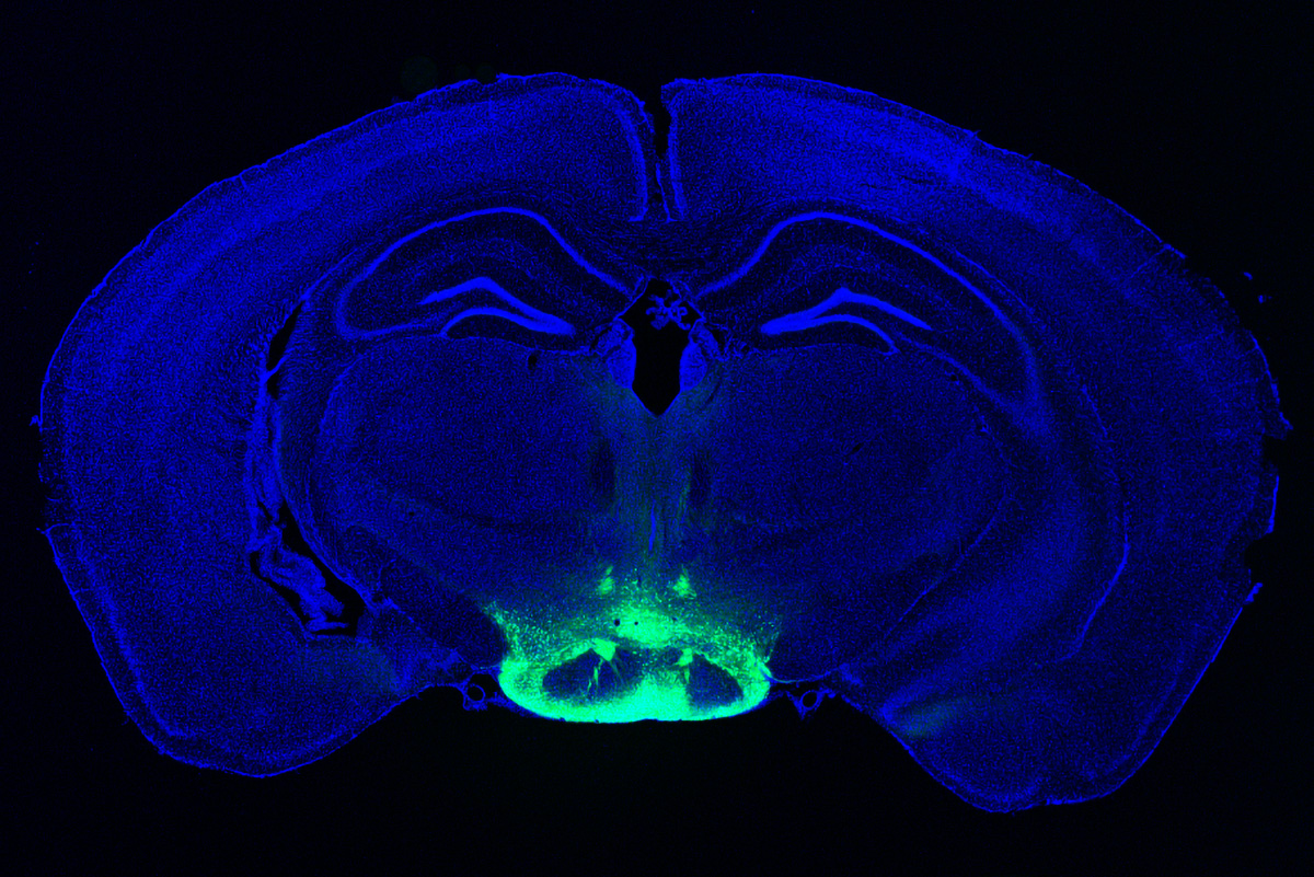 scan of a human brain with some neurons highlighted in green