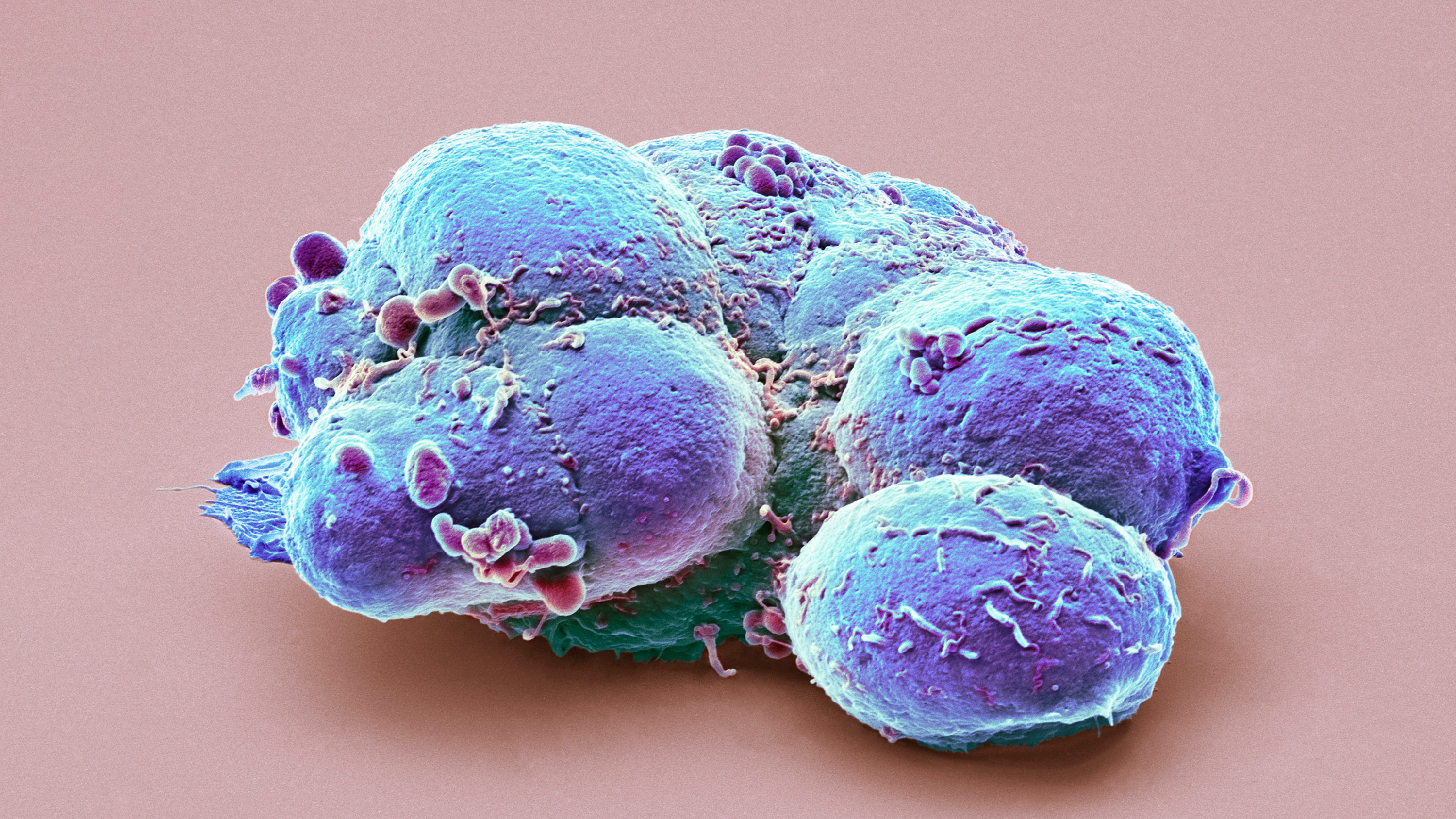 Colored scanning electron micrograph (SEM) of a clump of pluripotent embryonic stem cells.