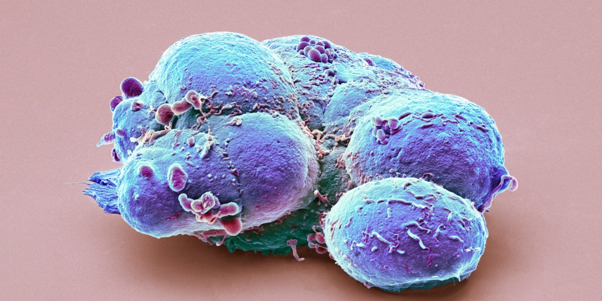 Эмбриональные стволовые клетки после 25 лет ажиотажа все еще ждут своего часа