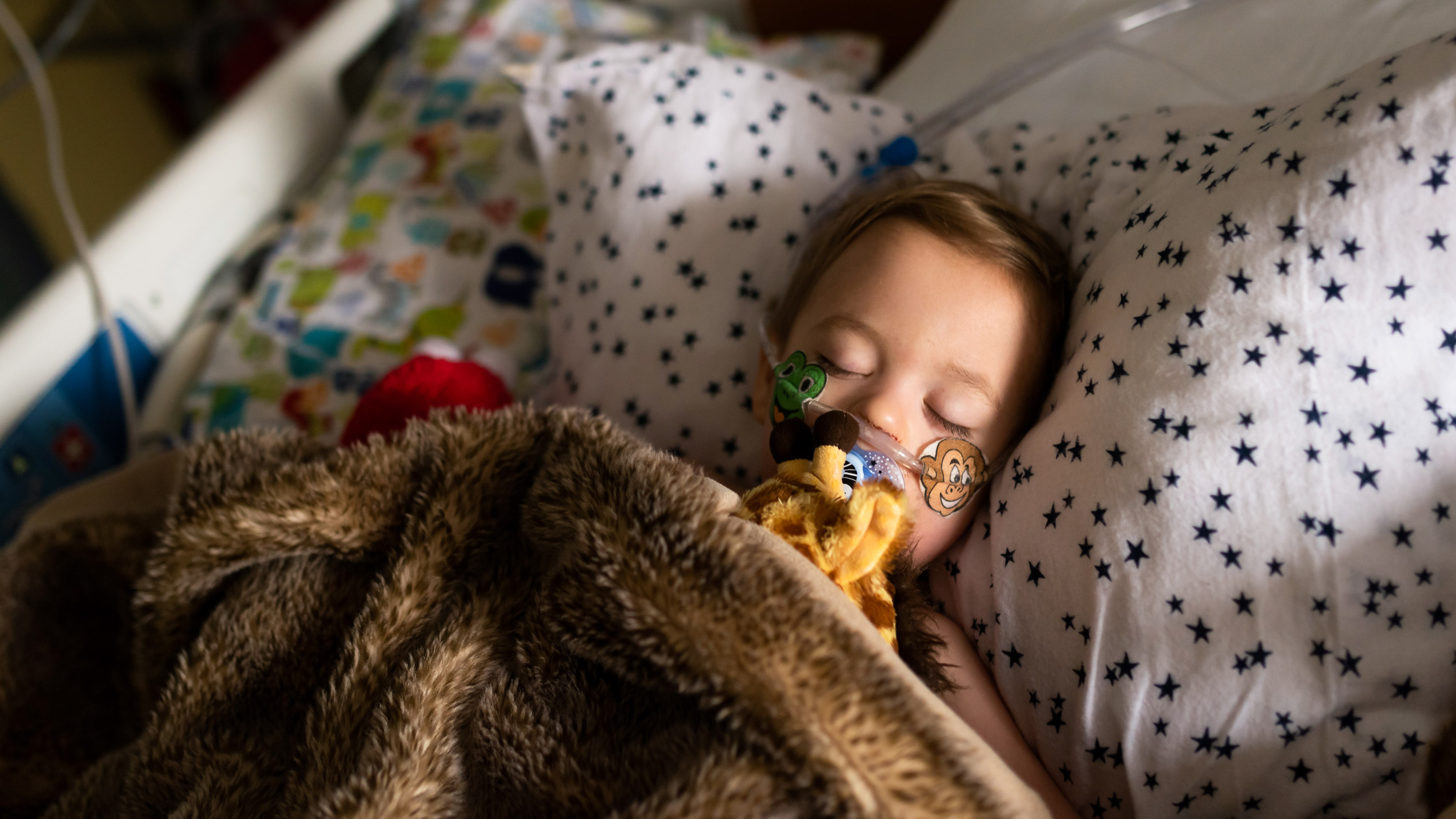 Toddler sleeping in hospital pediatric intensive care unit with oxygen tubes