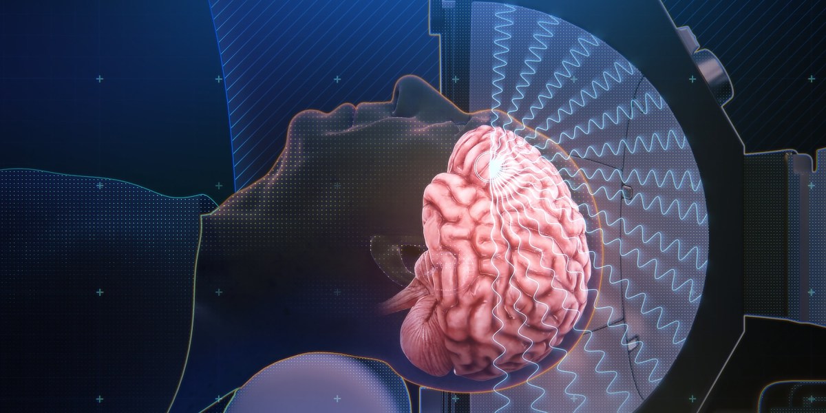 La innovación que consigue que un fármaco contra el Alzheimer atraviese la barrera hematoencefálica
