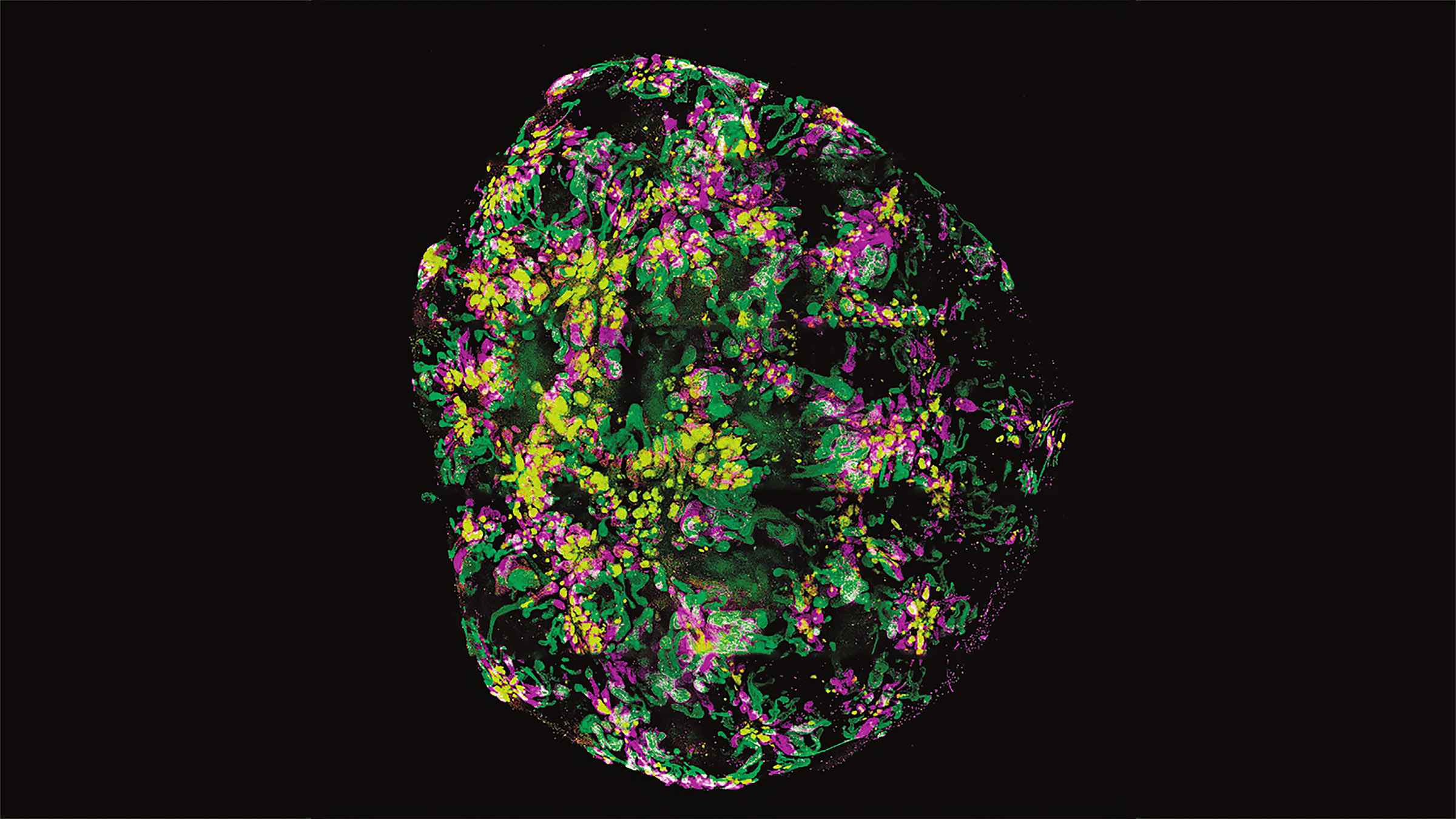 A kidney organoid generated from a human pluripotent stem cell