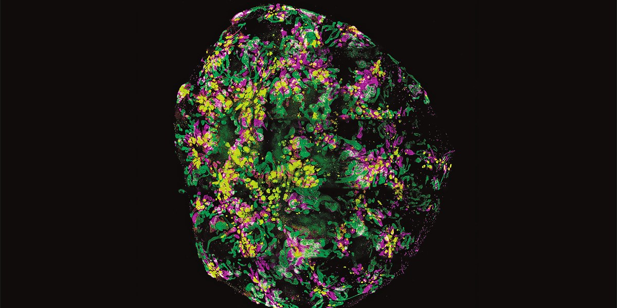 The Download: organoid uses, and open source voting machines