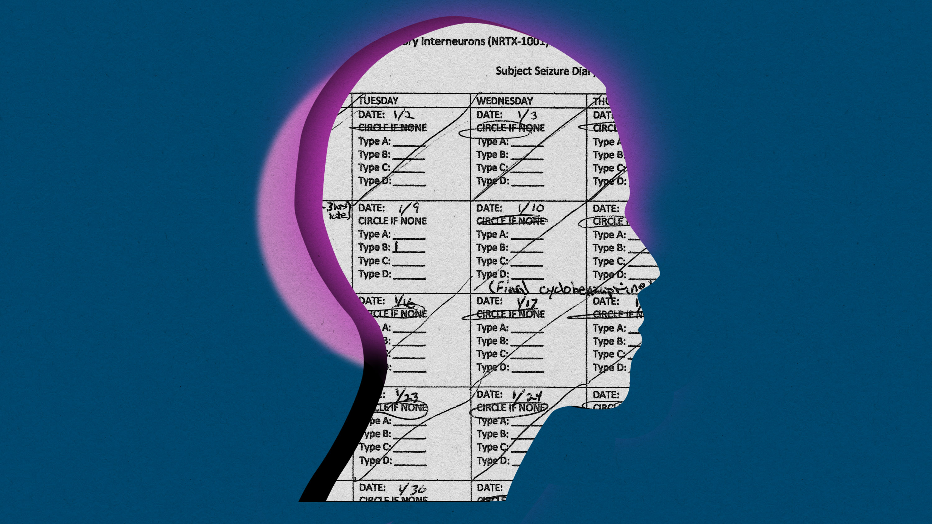page from an epilepsy journal in the shape of a human head in profile