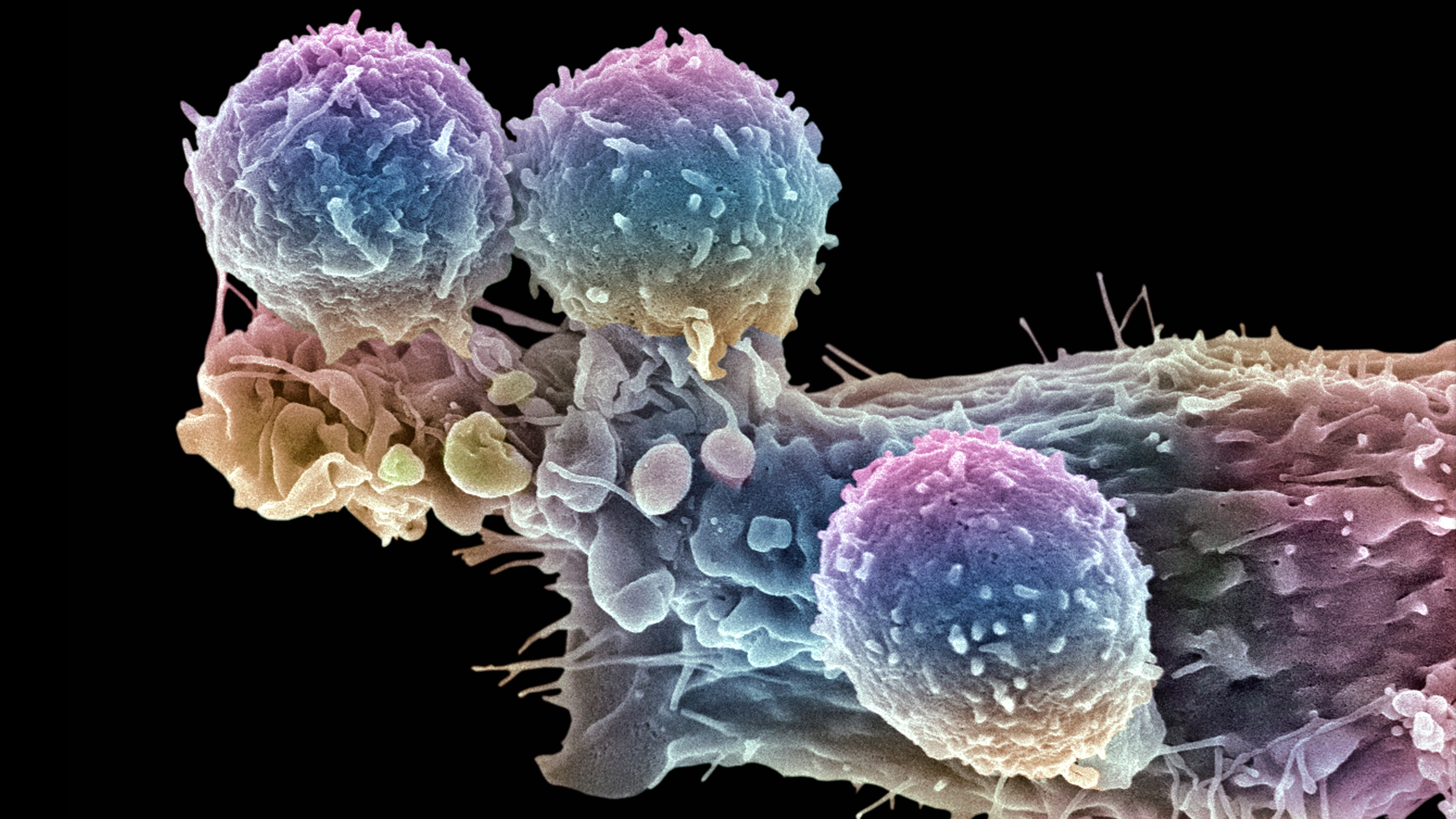 T lymphocytes and cancer cell.
