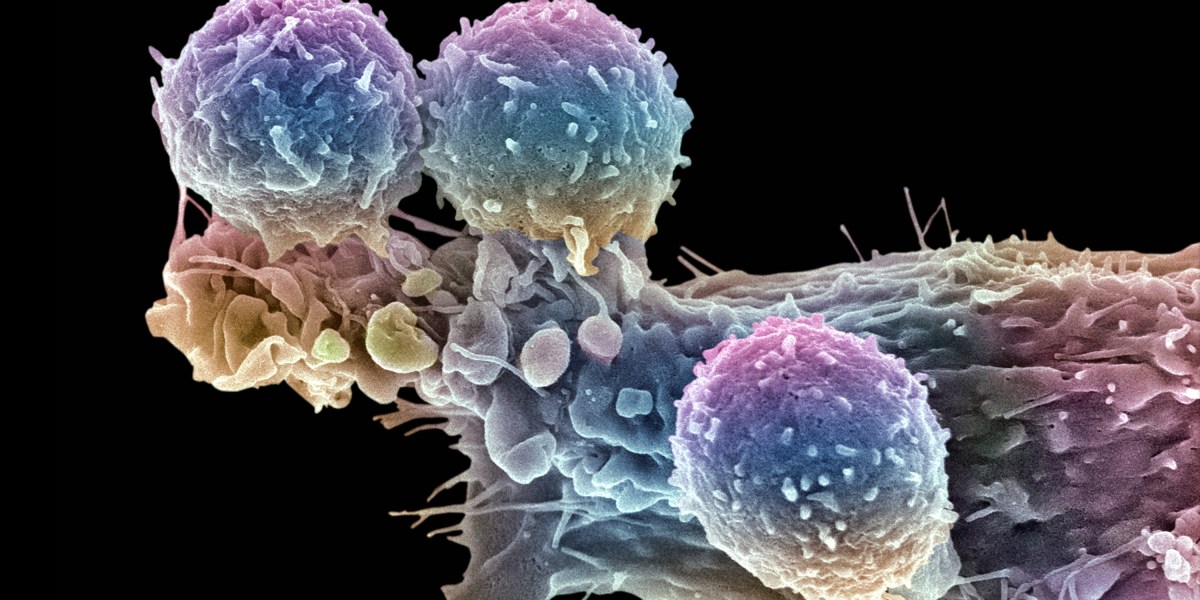 El esfuerzo por abaratar una innovadora terapia contra el cáncer