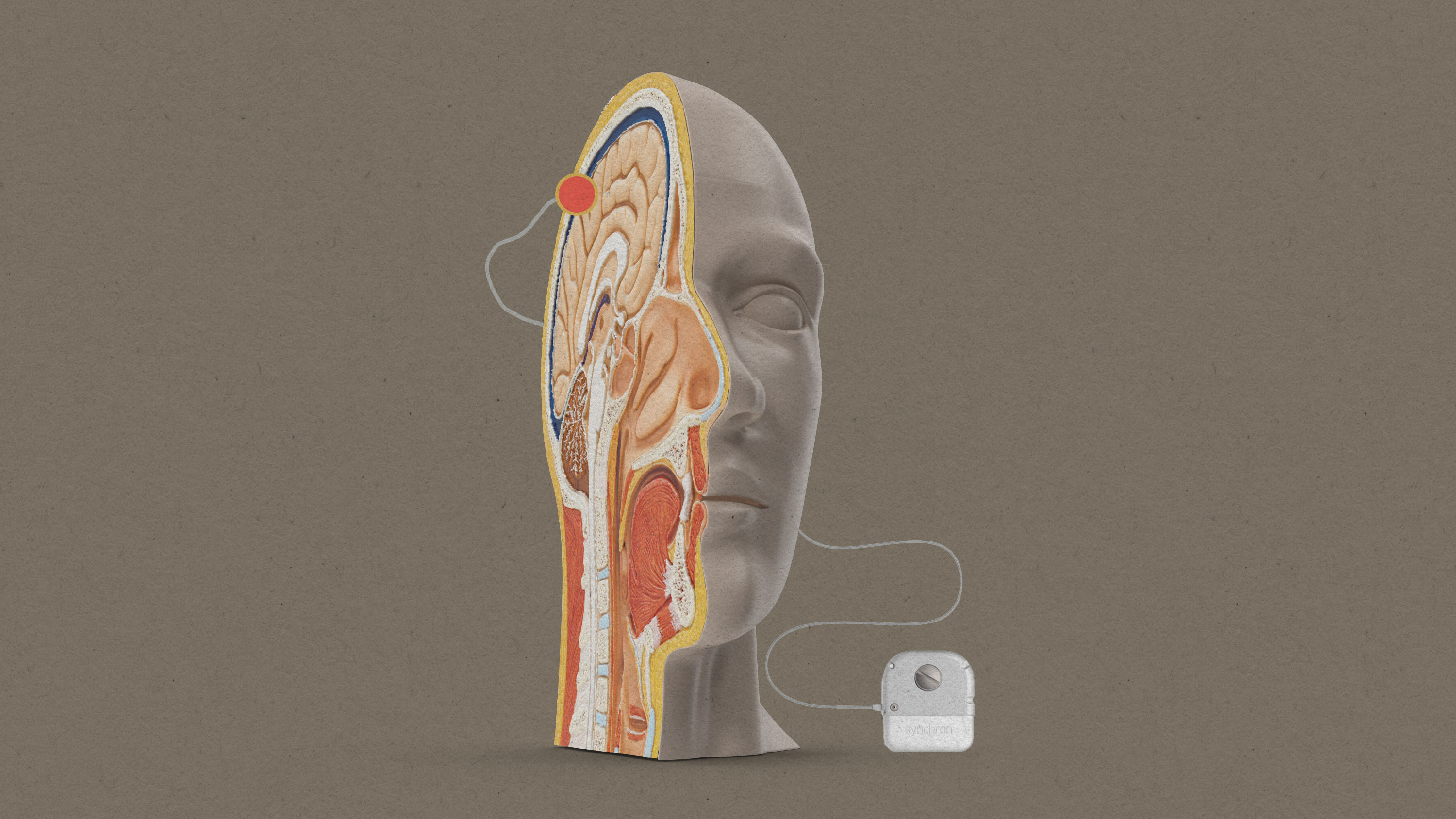 cross section of a generic human head with a lead extending to the brain looping down to the Synchron device