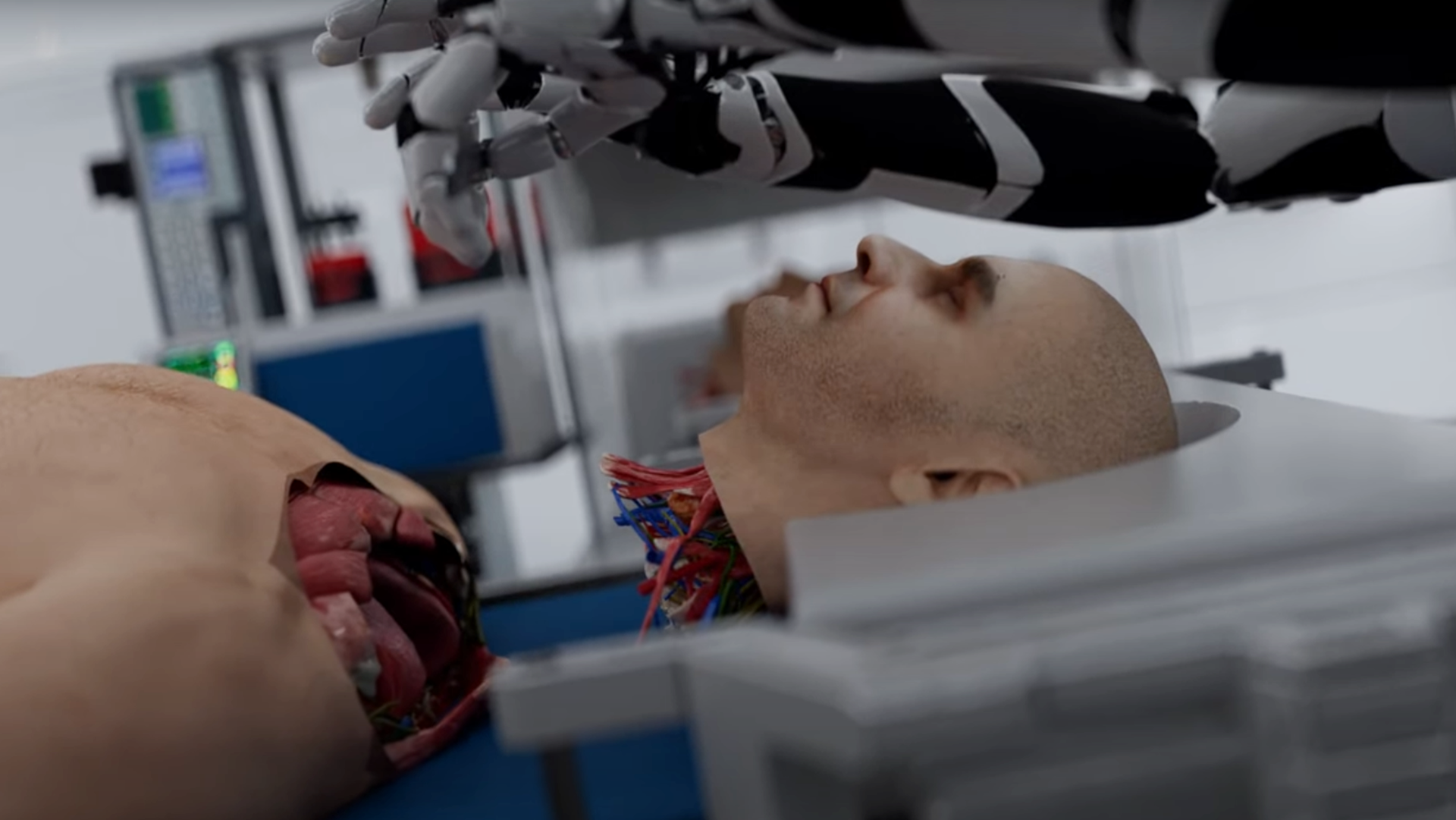 screenshot from a video with anthropomorphic robot arms hovering over a human head detached from the body, lying on a surgical table