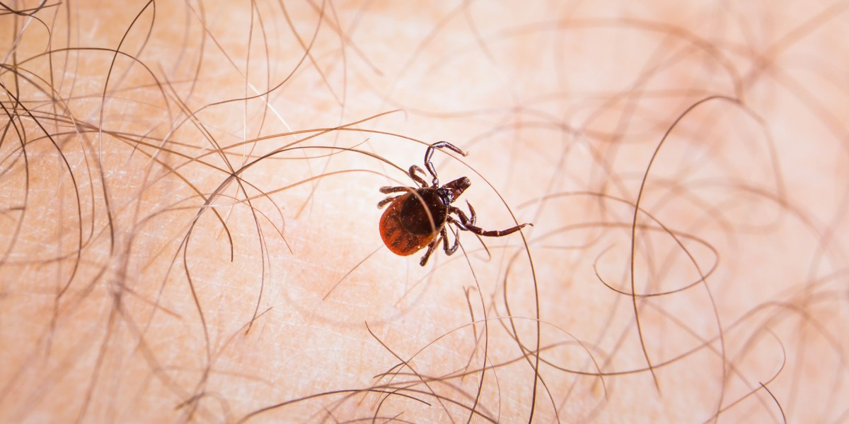 Sweat may protect against Lyme disease